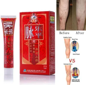 Varicose Veins Treatment Cream